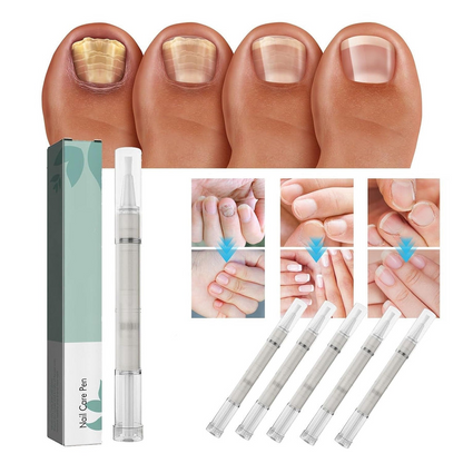Avelena |  NailBloom – Sag brüchigen Nägeln für immer Lebewohl
