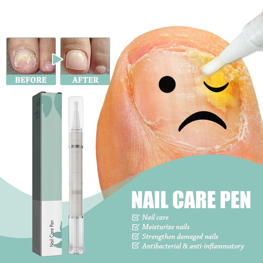Avelena |  NailBloom – Sag brüchigen Nägeln für immer Lebewohl