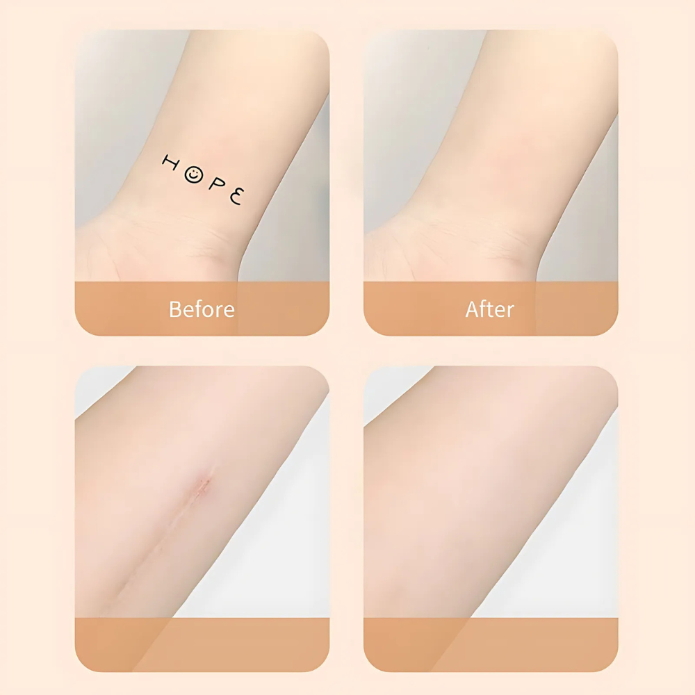 Avelena | Scar Concealer Patch Waterproof Skin Cover