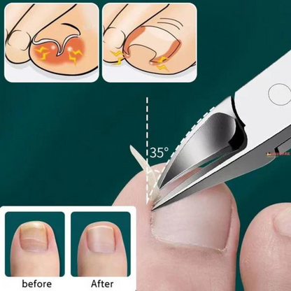 Avelena | Globetrek Nipper Professionelle Nägel und Nagelhaut Zange